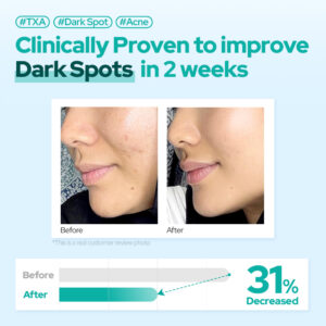 Dr. Belmeur Niacinamide/TXA Dark Spot Serum 30ml - Image 3